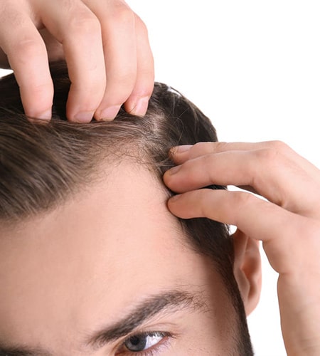 کاشت مو به روش FIT برای چه افرادی مناسب است؟